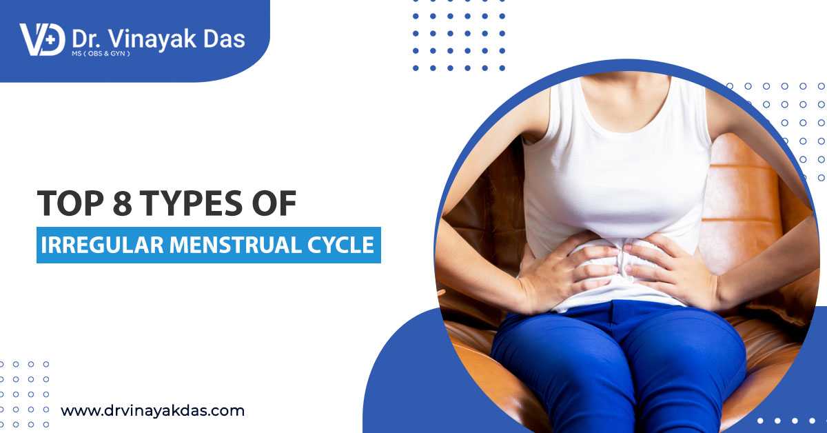 Top 8 Types Of Irregular Menstrual Cycle