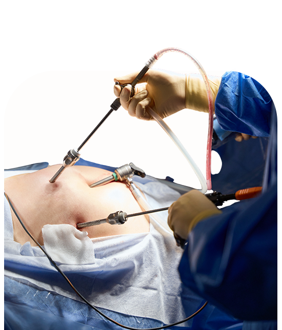 Gynecology Treatment in Siliguri